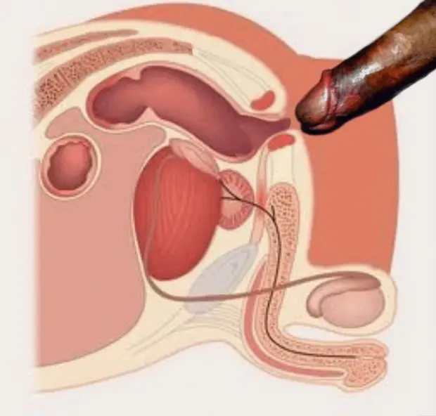 Anatomy of aBBC entering sissy pussy with shrinking limp clit