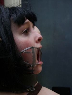 mouth-gag