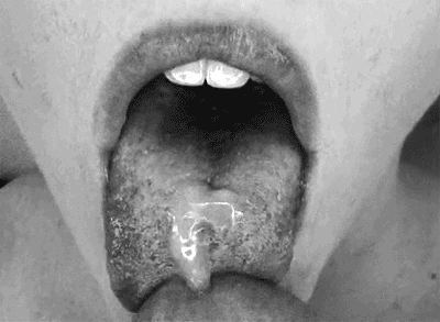 Hot tongue