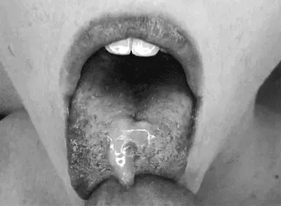Hot tongue
