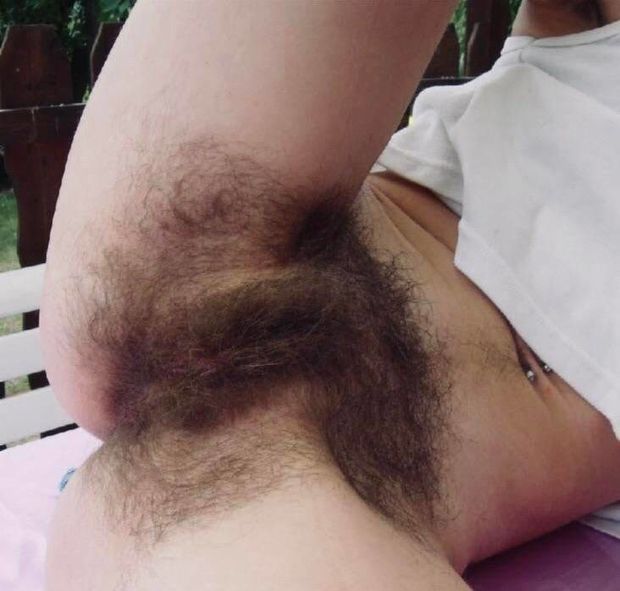 Lots of hair