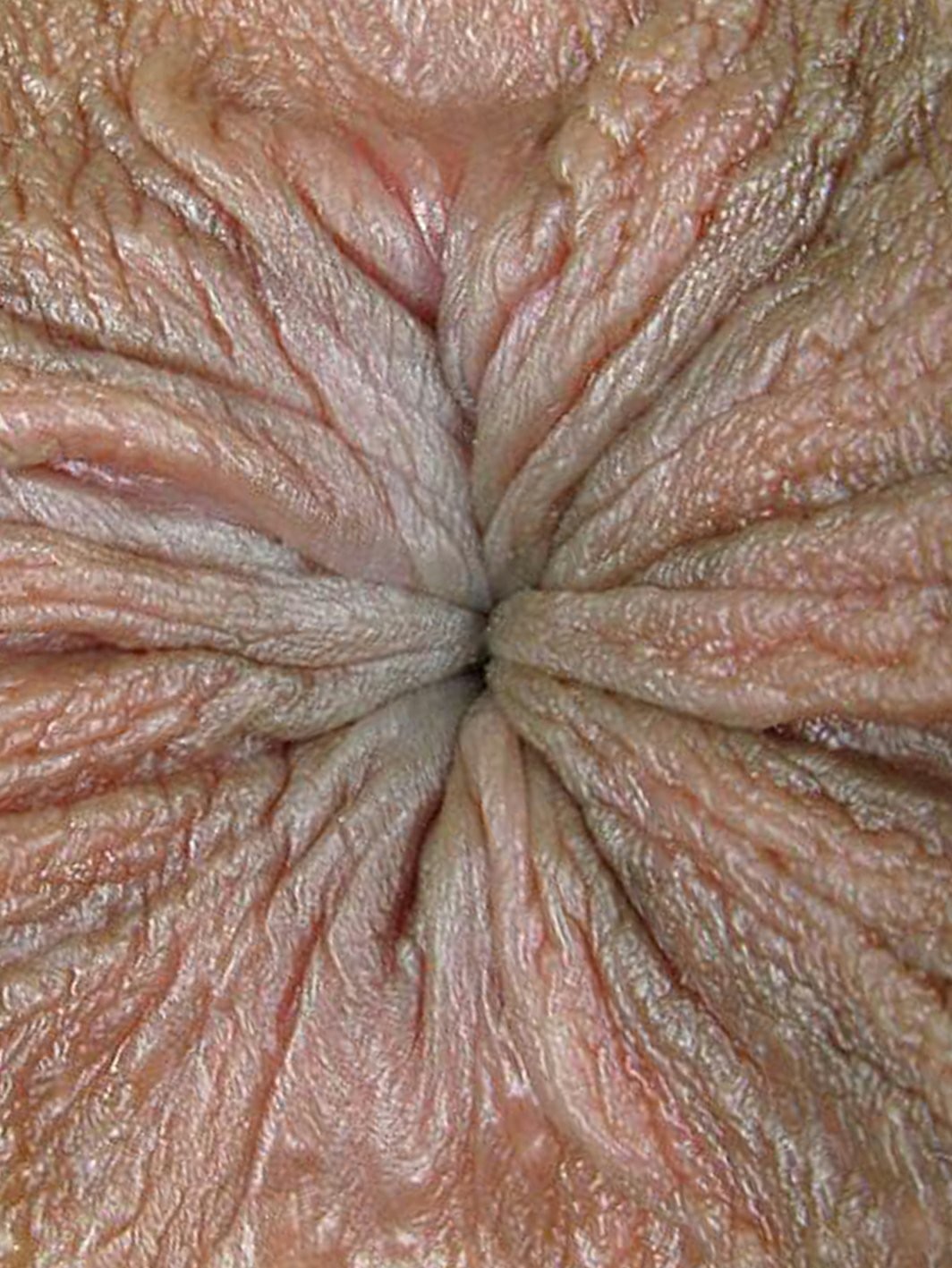 Pucker up