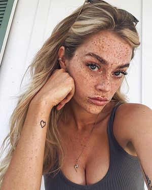 freckles look