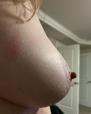 Side boob kind of day