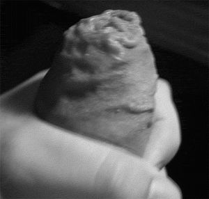 Masturbating foreskin