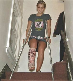 Couldn't get my panties over my cast