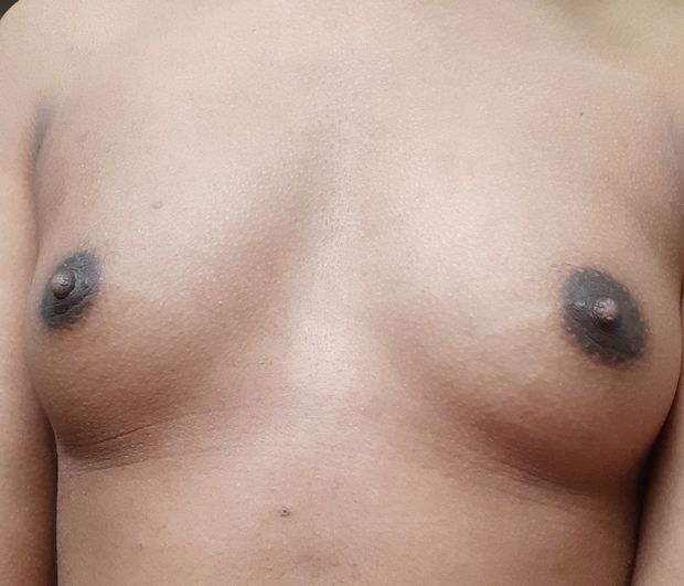 tiny boobs