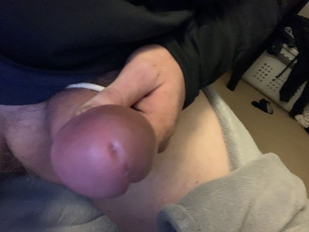 My swollen knob