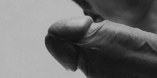 close uppie