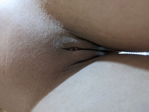 Bare