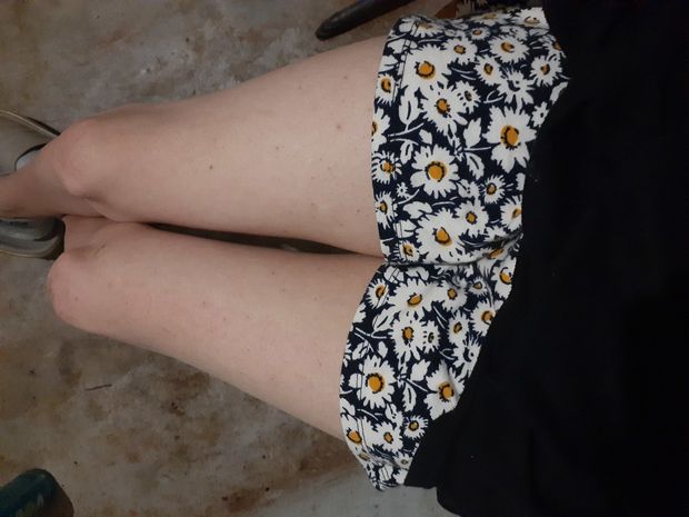 Just my skinny n white legs,