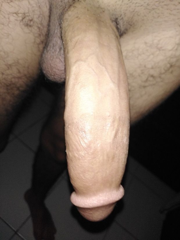 Third leg