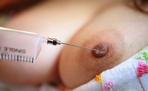 Nipple injection