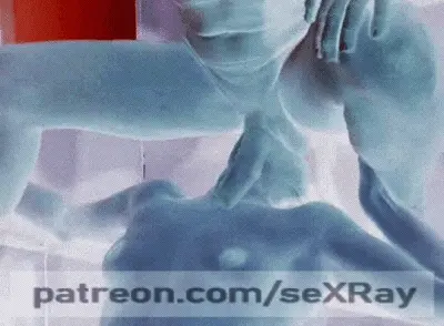Negative Sex X-ray