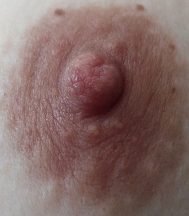 Nipple