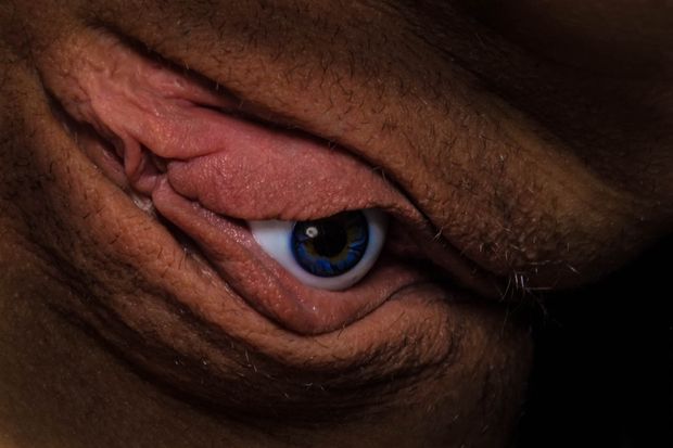 Droppy eye