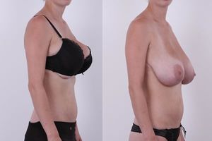 PERFECTION (Monika / From: Czechcasting)