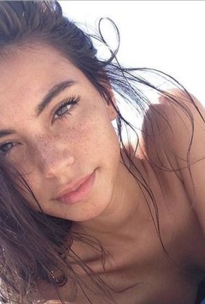 Freckles