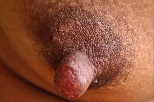 Tit nipple