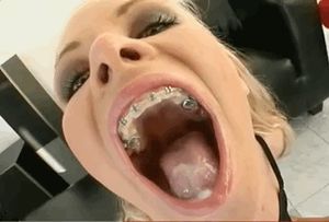 Braces Swallow
