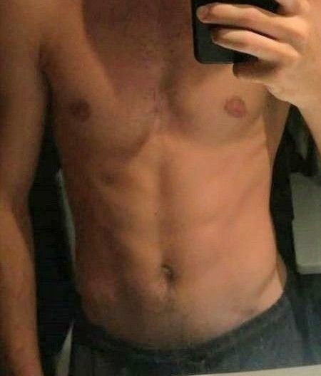 Hot body
