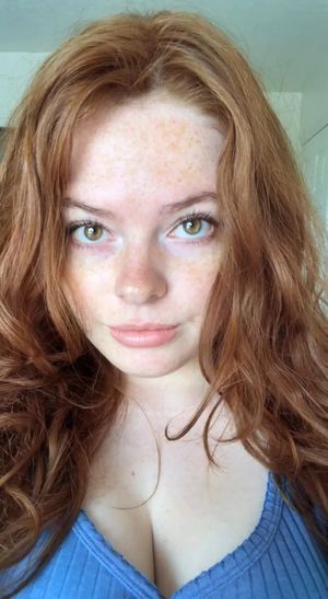Bright eyes and freckled face
