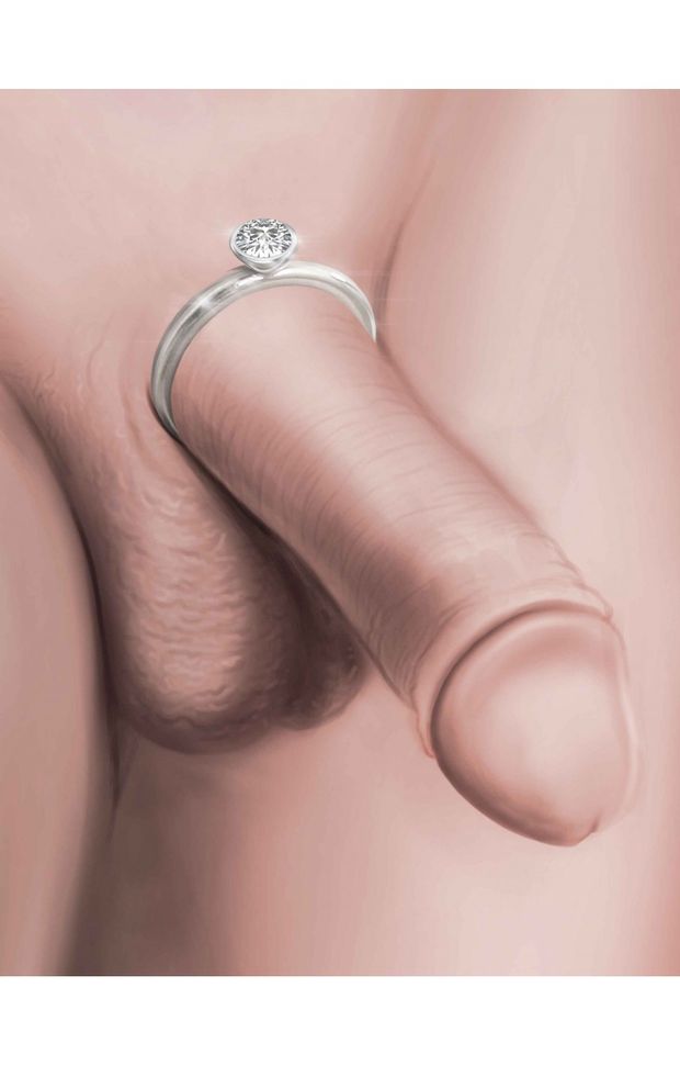 Magnate - Solid Sterling Silver Penis Ring
