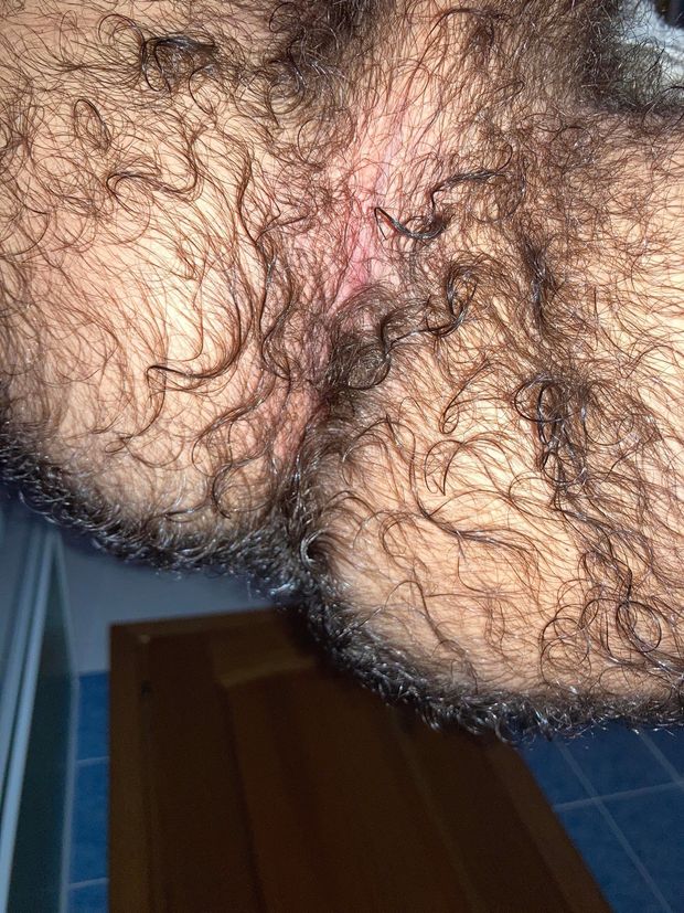 Hairy ass