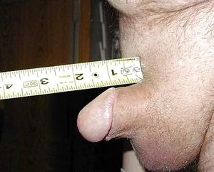 micro penis