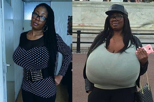 Haruhi Miwako Before/After