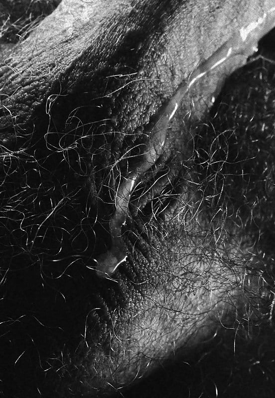 Hairy balls