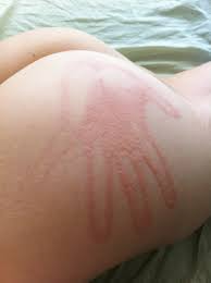 Spank Mark