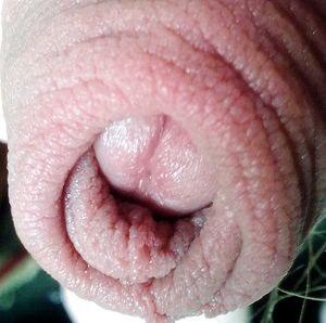 Mmmmm! Thick double foreskin to chew on!