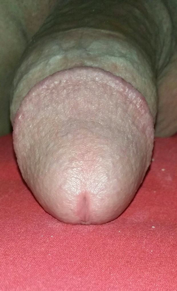 A head before the shaft