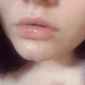 kiss