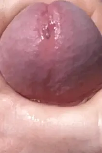 Up close