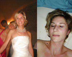 Facial Before after1