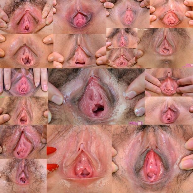 Women