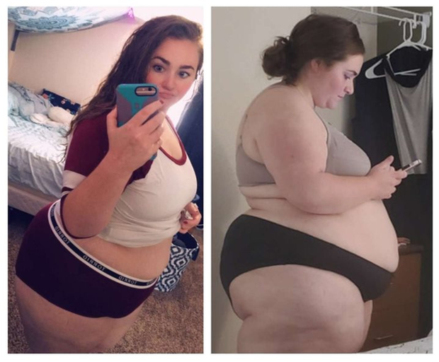 weight gain