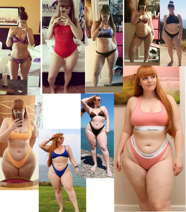 weight gain
