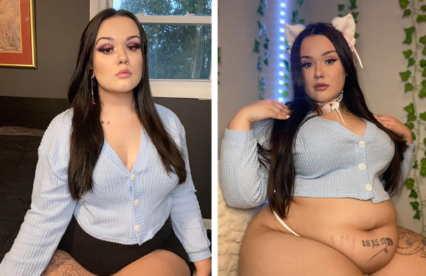 weight gain