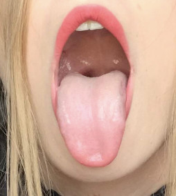 "Open Wide"