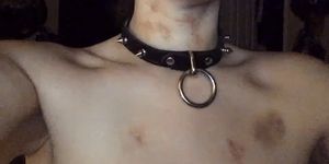 Proudly wear her bruises.