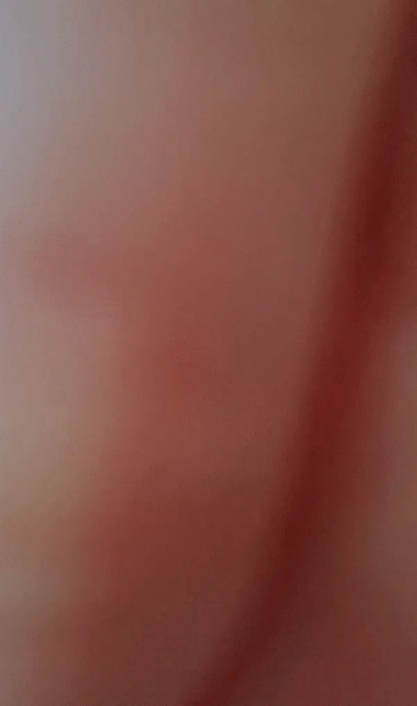 Surprise