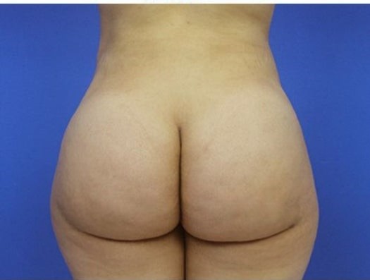 ASS