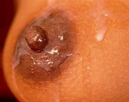 Nipple Lotion