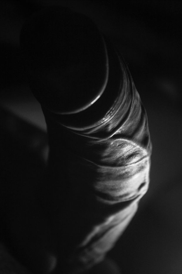 veins