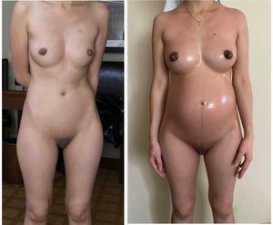 Rose544 before and during