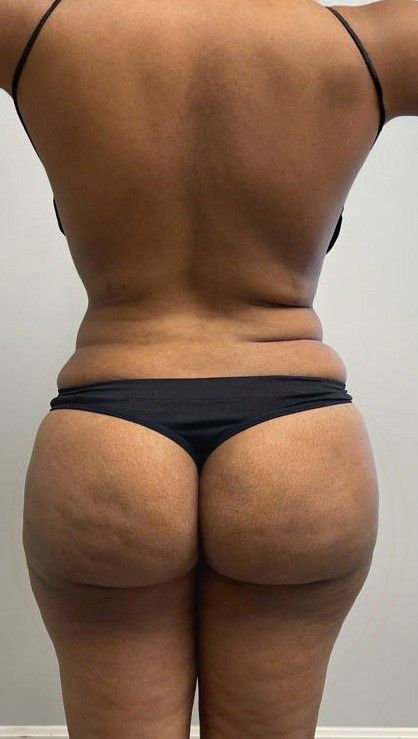 ASS