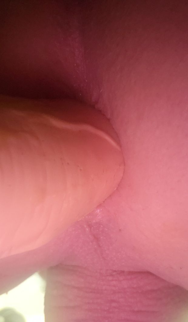 close up